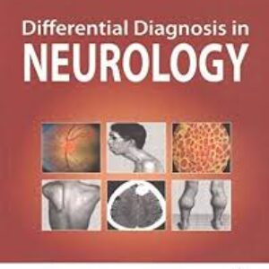 Differential Diagnosis in Neurology