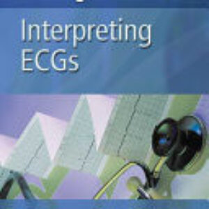 Nursing Know-How: Interpreting ECGs